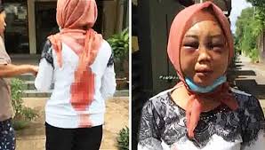 Rozita didakwa dengan sengaja menyebabkan kecederaan parah terhadap suyanti sutrinso dengan menggunakan sebilah pisau berhulu biru, sebatang pengelap lantai, sekaki payung, sebatang rod besi berwarna biru, sebatang alat mainan kucing dan penyangkut baju berwarna putih yang digunakan. Siapa Datin Rozita Mohamad Ali