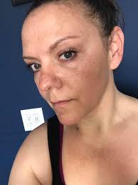 Benefits of not bathing daily for skin