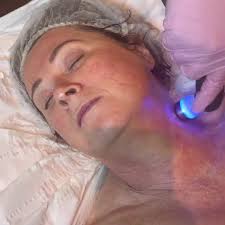 Our Dermaregen HYDRAGLOW Facial