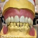 CerDent Dental Labor (@CerDent) / X
