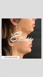 Dr. Ahmed ElSobky Clinics (@dr.elsobky_cosmetic_clinics) • Instagram photos  and videos