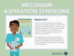 Meconium Aspiration Birth Injury Attorneys