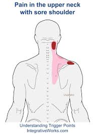 Pin On Health