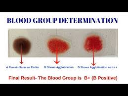 blood group test different types of blood group by solution