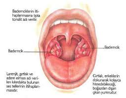 Bademcik Sismesi Tonsilit Nedir Health Anatomy Movie Posters