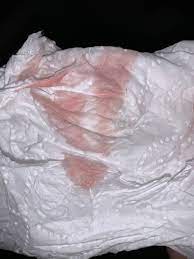 Pink mucus 7 weeks pregnant. Pink Discharge At 9 Weeks Tmi Pic May 2021 Babies Forums What To Expect