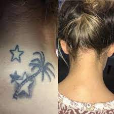 The piqo4 tattoo removal laser is one of the newest, quality made lasers on the market today. Cleveland Oh Ink On Ink Off Laser Tattoo Removal