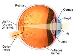 Image result for Refractive Error