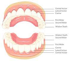 Wisdom teeth are the last erupting teeth in the dental arch and become impacted due to various reasons. What Are Wisdom Teeth