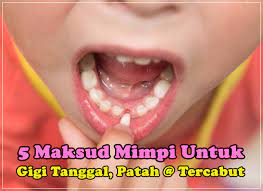 Arti mimpi gigi goyang menurut islam, primbon dan psikolog. 5 Maksud Mimpi Untuk Gigi Tanggal Patah Dan Tercabut