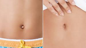 People Are Getting Plastic Surgery On Their Belly Buttons Now Plastic Surgery Plastic Surgery Procedures Surgery