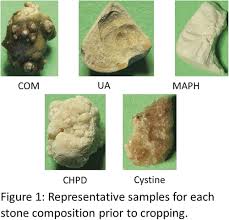 Pd04 06 Deep Learning Computer Vision Algorithm For Detecting Kidney Stone Composition Towards An Automated Future Journal Of Urology