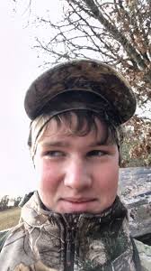 Whitetail Buck Back Injury Combine