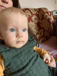 Help. Been refered to GOSH in London but still waiting for appointment. Her  head got better since born. She was breech all the time and born c section.  Do you think is