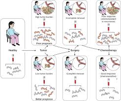 We did not find results for: Methylated Circulating Tumor Dna In Blood Power In Cancer Prognosis And Response In Endocrine Related Cancer Volume 23 Issue 3 2016