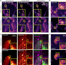 Aqui você encontra livros, filmes, comentários. Democratising Deep Learning For Microscopy With Zerocostdl4mic Nature Communications