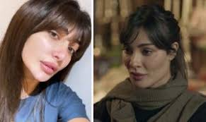 قبل إجراء عملية التجميل يجب تشخيص الحالة أولاً حيث أن هناك عدة عمليات لتجميل الأنف منها حدوث ردود الفعل التحسسية سواء من الأدوية أو أي من المواد المستخدمة أثناء الجراحة. Ù†ÙˆØ± Ø§Ù„ØºÙ†Ø¯ÙˆØ± Ø¨Ø¹Ø¯ Ø¹Ù…Ù„ÙŠØ§Øª Ø§Ù„ØªØ¬Ù…ÙŠÙ„ Ù†Ø³Ø®Ø© Ø¹Ù† Ù†Ø§Ø¯ÙŠÙ† Ù†Ø¬ÙŠÙ… Jadeedoha