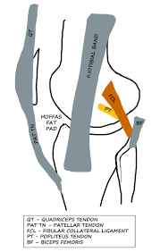 Many factors should be considered when discussing surgery including the athletes level of competition, age, previous knee injury, other injuries sustained, leg alignment, and graft choice. Epos