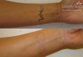 Though there are numerous options for everyone to choose from, it is not as easy as it appears due to the. Omaha Cosmetic Surgery Tattoo Removal Skin Specialists Pc Lovelyskin
