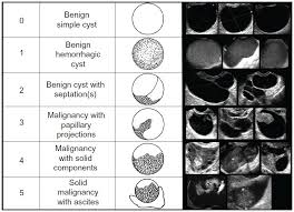 The results in 4350 patients confirmed that ultrasound examination, both transabdominal and transvaginal. Transvaginal Ultrasonography In Ovarian Cancer Screening Current Pers Ijwh