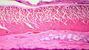 This type of epithelia lines the small intestine where it stratified squamous epithelia consist of multiple layers of cells with the outer most layer being squamous. Stratified Squamous Epithelium Under The Stock Footage Video 100 Royalty Free 8911033 Shutterstock