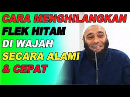 Cara Menghilangkan Flek Hitam Di Wajah Secara Alami Dan Cepat Dr Zaidul Akbar Youtube Perawatan Wajah Wajah Flek Hitam