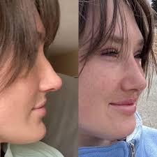 My consultation with a plastic surgeon is sure to raise some eyebrows….