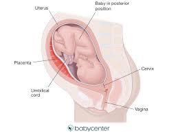 Image result for Manual Rotation in Occipitoposterior Presentation