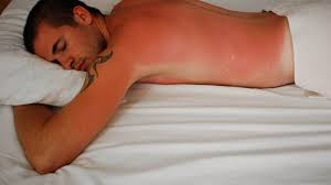 These symptoms usually show up a few hours after your sun overexposure, but it could take a day or longer to know just how bad your burn is, the mayo clinic says. How To Sleep With A Sunburn 6 Userful Tips Terry Cralle