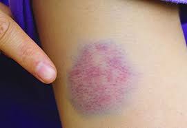 9 triệu chứng 'điển hình' báo hiệu trẻ nhỏ bị u ng th ư giai đoạn đầu: Mẹ  đưa con đến viện ngay 👇👇