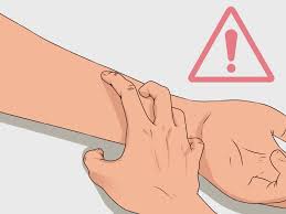 How To Properly Place A Tb Skin Test With Pictures Wikihow