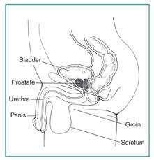 Image result for Prostatitis General Measures