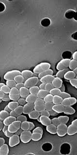 Image result for Vancomycin Resistant Enterococcus