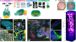 Common soft tissue injuries occur from a sprain, strain or soft tissue injuries. Tissue Clearing Technique Recent Progress And Biomedical Applications Tian 2021 Journal Of Anatomy Wiley Online Library