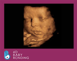 4D Baby Scan Manchester — Ultrasound Elite Manchester