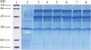 Easily build your own triple 4′ x 8′ aluminum dock on posts. Mutational Analysis Of Ocriplasmin To Reduce Proteolytic And Autolytic Activity In Pichia Pastoris Biological Procedures Online Full Text