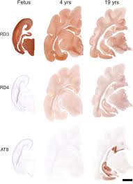 Research varies on the ability of the clock drawing test to differentiate between, for example, vascular dementia and alzheimer's disease. The Domestic Cat As A Natural Animal Model Of Alzheimer S Disease Acta Neuropathologica Communications Full Text