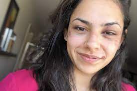 Ariane's response will appear in this area. Ariane Lipski Says She Fractured Her Face In Loss To Antonina Shevchenko At Ufc 255 Mma Fighting
