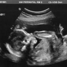 Sama seperti cara di atas, gunakan soda bikarbonat (tepung penaik) bersama air. Services Sonoworld Centre