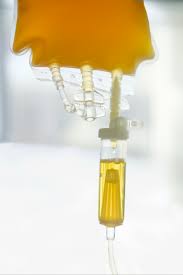 Image result for Plasma Transfusion