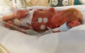 The fetus development the fertilization occurs about two weeks after the first day of the last finding out i was pregnant with my son max when my daughter olivia was only 10 weeks old provided plenty of laughs for everyone but me. I Was 30 Weeks And Two Days Pregnant And In Labour
