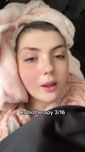 Radiotherapy 3/16 Update