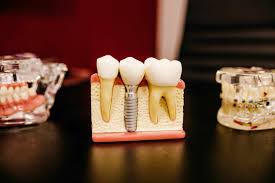 Program requirements vary, however, like most phd programs, a phd in malaysia requires extensive research in the field of study that leads to the writing for a dissertation or. What Is Dentistry Course