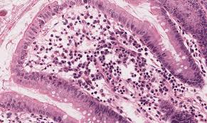 It also surrounds the blood vessels and nerves. Connective Tissue Histology