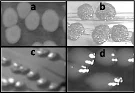 Enteritidis can be controlled by thorough cooking of eggs (i.e., until there… Morphotypes Of Salmonella Enterica Isolates Colony Morphology Was Download Scientific Diagram