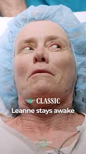 #OnThisWeek in #ShortlandStreet history, Leanne stayed awake under the  knife 😳, See more in Leanne’s episode of #ShortySelects, streaming now