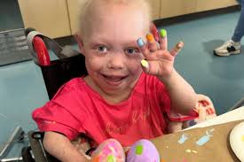 Bella Brave, tiktoker com doença rara, morre aos 10 anos