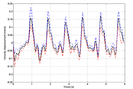 Understand quartiles inter quartile range and box whisker plot statistics. Typical Velocity Displacement Distribution Of Brain Tissue The Solid Download Scientific Diagram