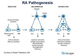 Rheumatoid Arthritis Pathophysiology And New Biologic Therapies