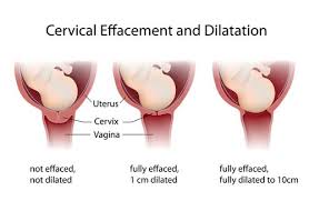 Dilation Of The Cervix What You Need To Know Bellybelly